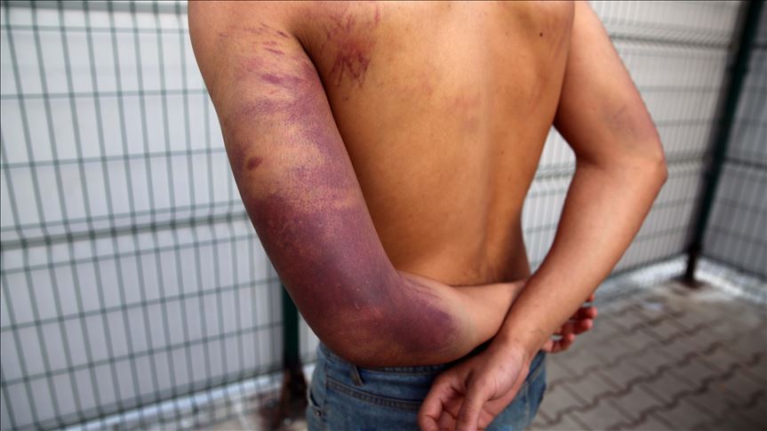 Increase in Torture and Extortion of Migrants by Human Traffickers on the Iran-Turkey Route