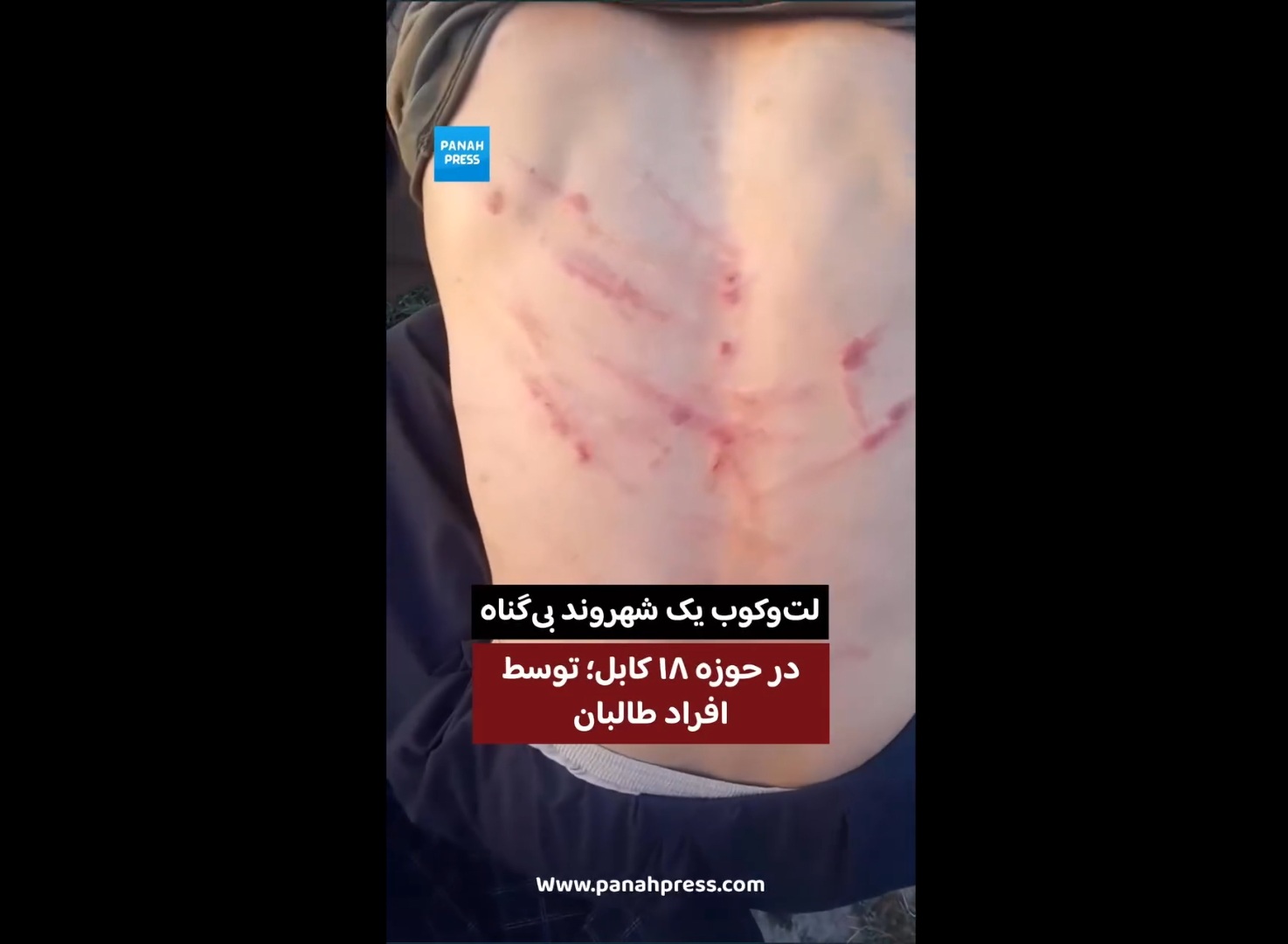 لت‌وکوب یک شهروند در حوزه ۱۸ کابل زیر حاکمیت طالبان